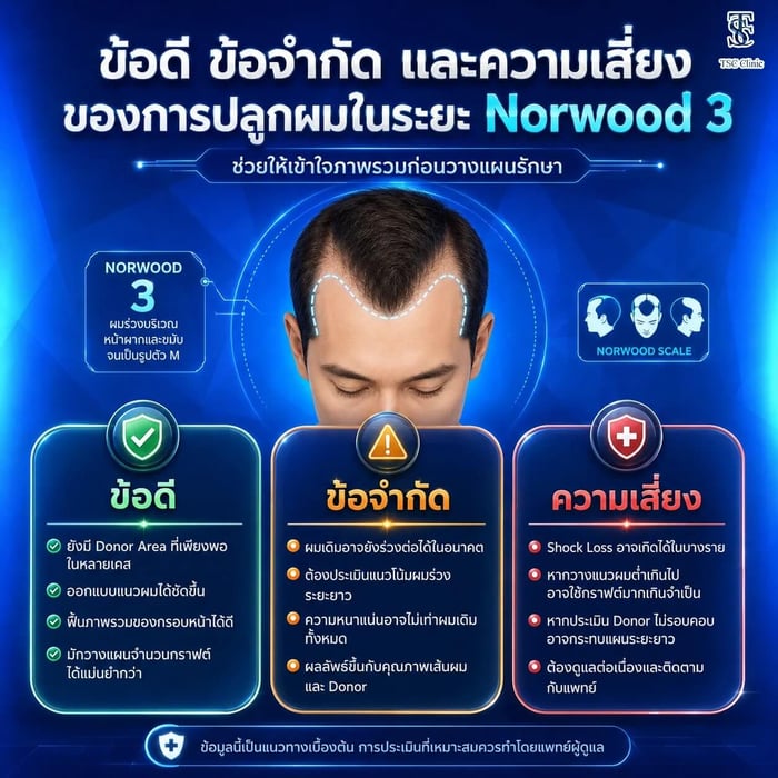 ข้อดี ข้อจำกัด และความเสี่ยงของการปลูกผมในระยะ Norwood 3