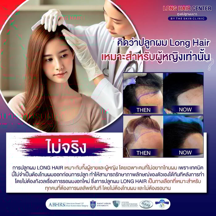 การปลูกผม Long Hair เหมาะสำหรับผู้หญิงเท่านั้น