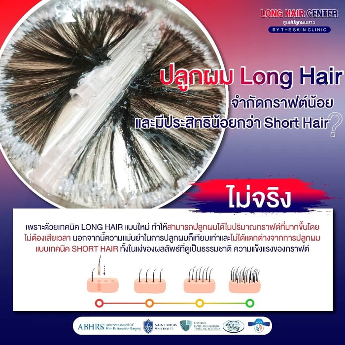 ปลูกผม Long Hair ใช้จำนวนกราฟต์น้อย และมีประสิทธิภาพน้อยกว่า Short Hair?
