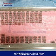 กราฟต์ผมแบบ Short Hair: กราฟต์ผมมีลักษณะเป็นตอผมสั้น เนื่องจากเจาะเอาแต่กราฟต์ผมที่ผ่านการตัดผมด้านหลังมา จากนั้นทำการคัดแยกกราฟต์ผมที่มีความสมบูรณ์เพื่อนำไปปลูก และต้องรอเวลาให้ผมขึ้นเต็มที่ถึงจะเห็นความหนาแน่นของเส้นผมขึ้นใหม่
