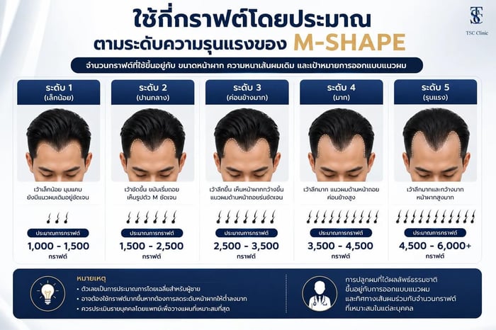 ตารางประเมินจำนวนกราฟต์ปลูกผมตามระดับความรุนแรงของหน้าผากตัว M
