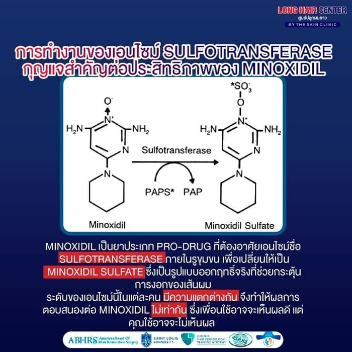ข้อจำกัด และผลข้างเคียงที่พบบ่อยของ Minoxidil แบบทา?