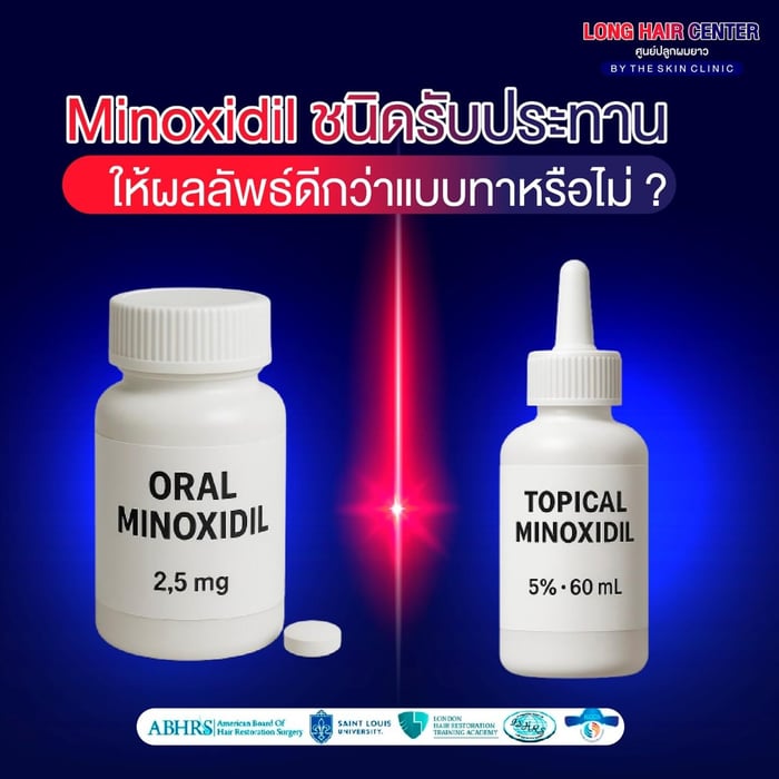 Minoxidil แบบรับประทาน vs แบบทา ตัวไหนดีกว่ากัน?