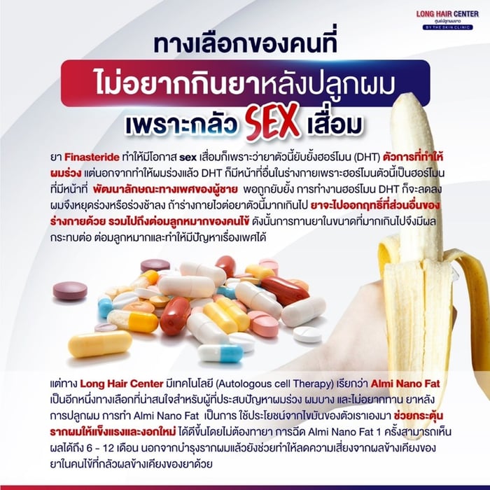 ถ้าไม่อยากกินยา มีวิธีใดบ้างในการรักษาผมร่วง ผมบาง ?