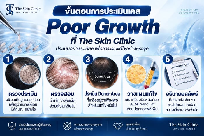 แพทย์ประเมินเคสกราฟต์ Poor Growth และวางแผนแก้ไขที่ The Skin Clinic