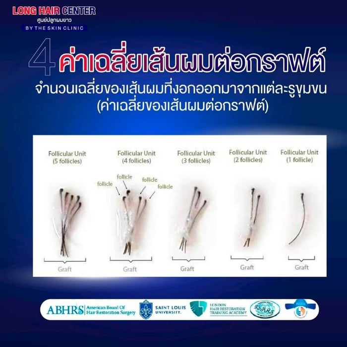 ค่าเฉลี่ยเส้นผมต่อกราฟต์