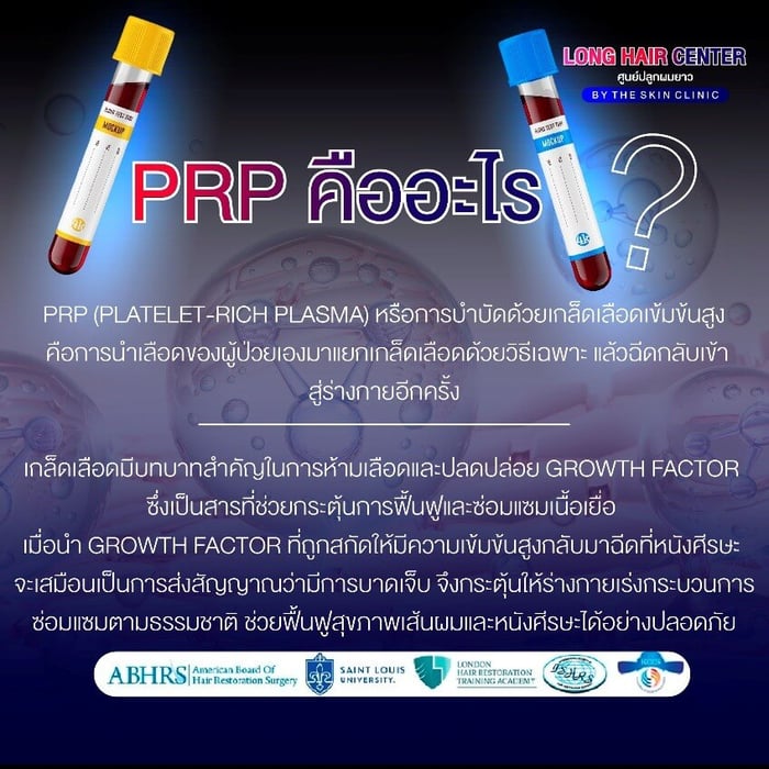 PRP คืออะไร?