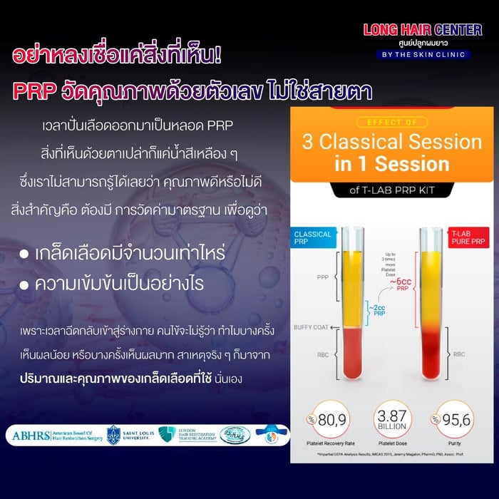 หัวใจสำคัญที่บ่งบอกถึงคุณภาพของ PRP 