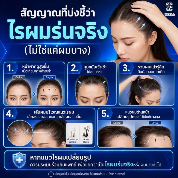 5 สัญญาณไรผมร่นในผู้หญิงที่ควรสังเกต