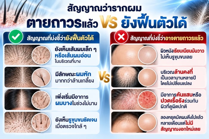 หยุดมัดผมตึงก่อนปลูกผม สัญญาณว่ารากผมตายถาวรแล้ว vs ยังฟื้นตัวได้