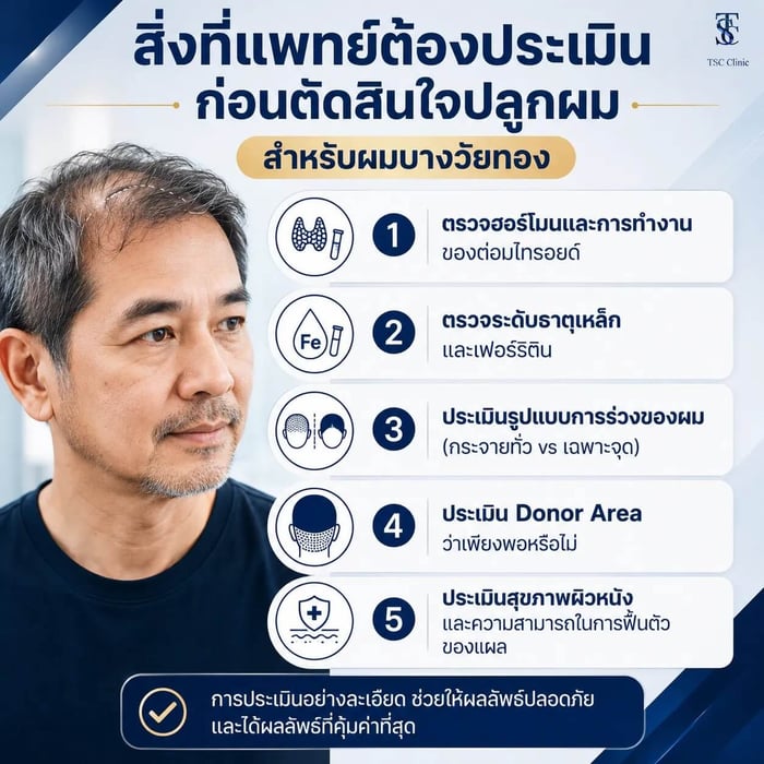 สิ่งที่แพทย์ต้องประเมินก่อนตัดสินใจปลูกผมสำหรับผมบางวัยทอง