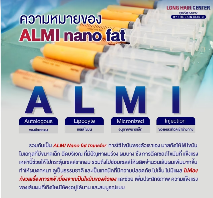 เทคนิค ALMI Nano Fat ฉีดไขมันกระตุ้นรากผม คืออะไร?เทคนิค ALMI Nano Fat ฉีดไขมันกระตุ้นรากผม คืออะไร?
