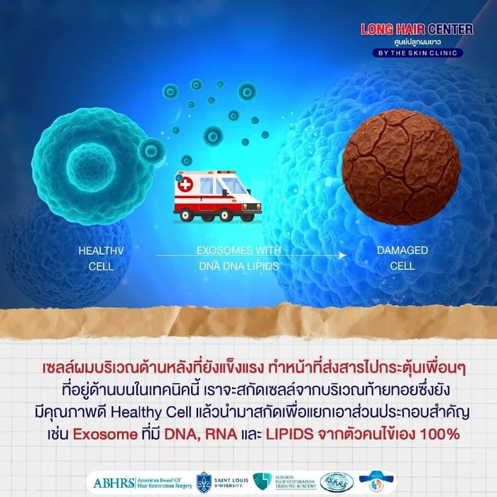 Micrografting Hair ช่วยแก้ปัญหาผมบางได้อย่างไร?