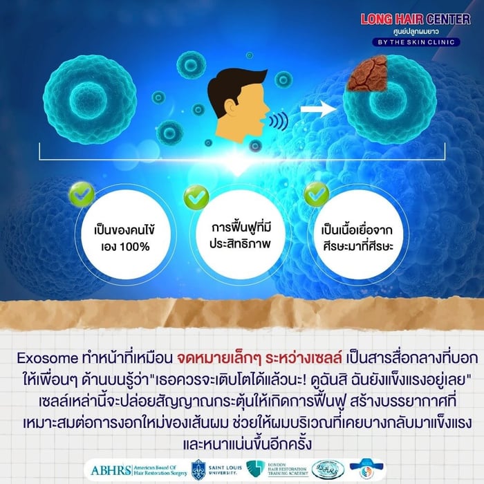 ข้อดีของปลูกผมด้วยเทคนิค Micrograft Hair Transplant?