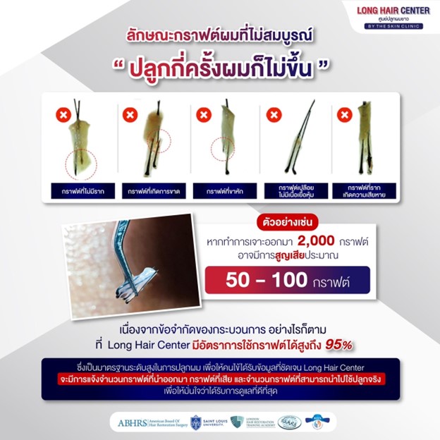 ทำไมทุกกราฟต์จึงไม่ได้ถูกนำมาใช้ทั้งหมด?