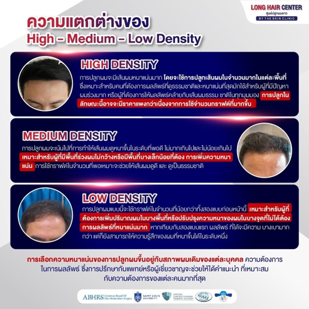 ความแตกต่างของ High – Medium – Low Density?