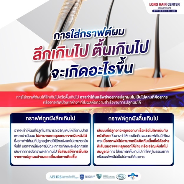 การใส่กราฟต์ผม ลึกเกินไปหรือตื้นเกินไป จะเกิดอะไรขึ้น?