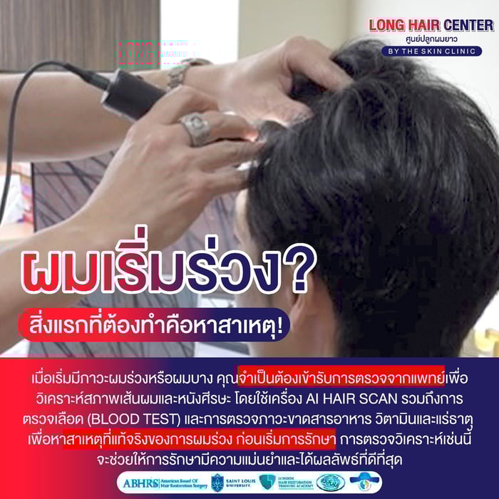 ผมร่วง, ปลูกผมที่ไหนดี