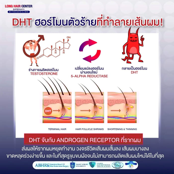 ยารักษาผมร่วง พลิกวงการ! นวัตกรรมด้วยเทคโนโลยี siRNA 