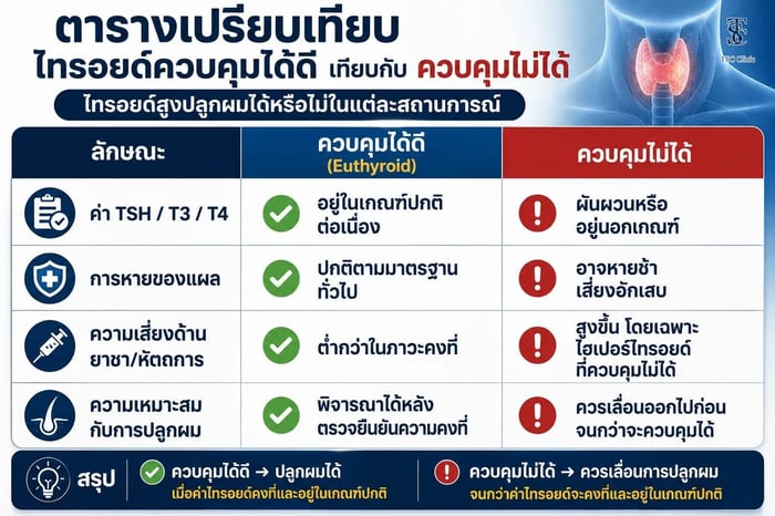 ใครเหมาะกับการปลูกผมและใครควรรอควบคุมโรคไทรอยด์ก่อน