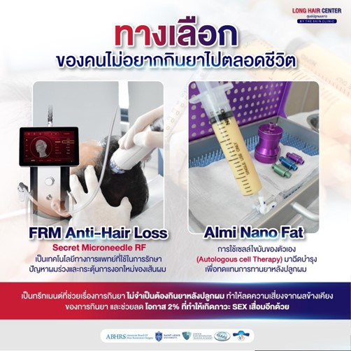 ทำไมต้องทำ ALMI Nanofat  ควบคู่กับการปลูกผม?