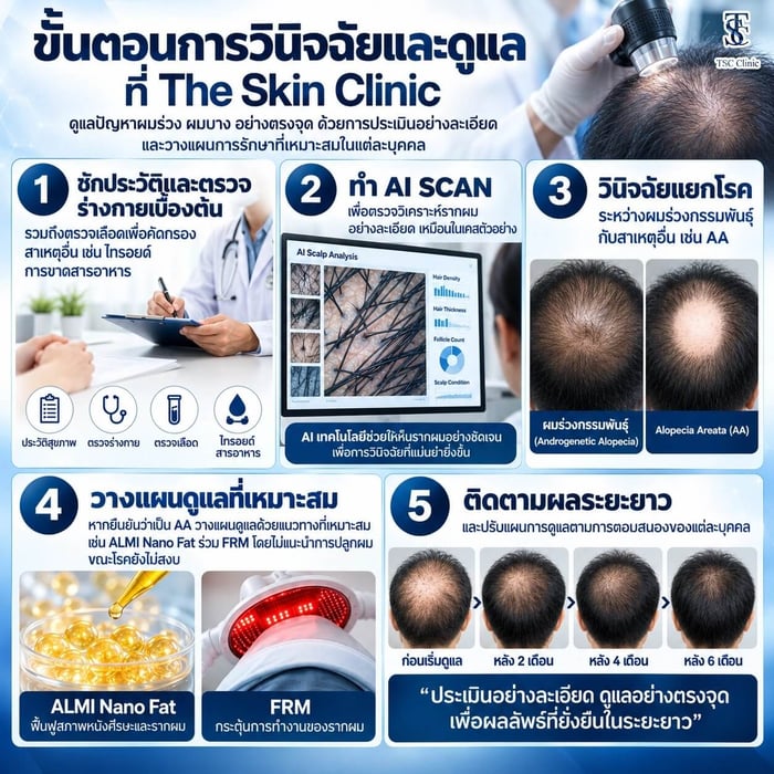 ขั้นตอนการวินิจฉัยแยกโรควัยรุ่นผมร่วงทั่วศีรษะที่ The Skin Clinic