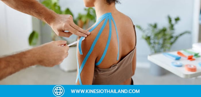 5 เรื่องที่นักกีฬาเข้าใจผิดเกี่ยวกับเทปพยุงกล้ามเนื้อ Kinesio Tape