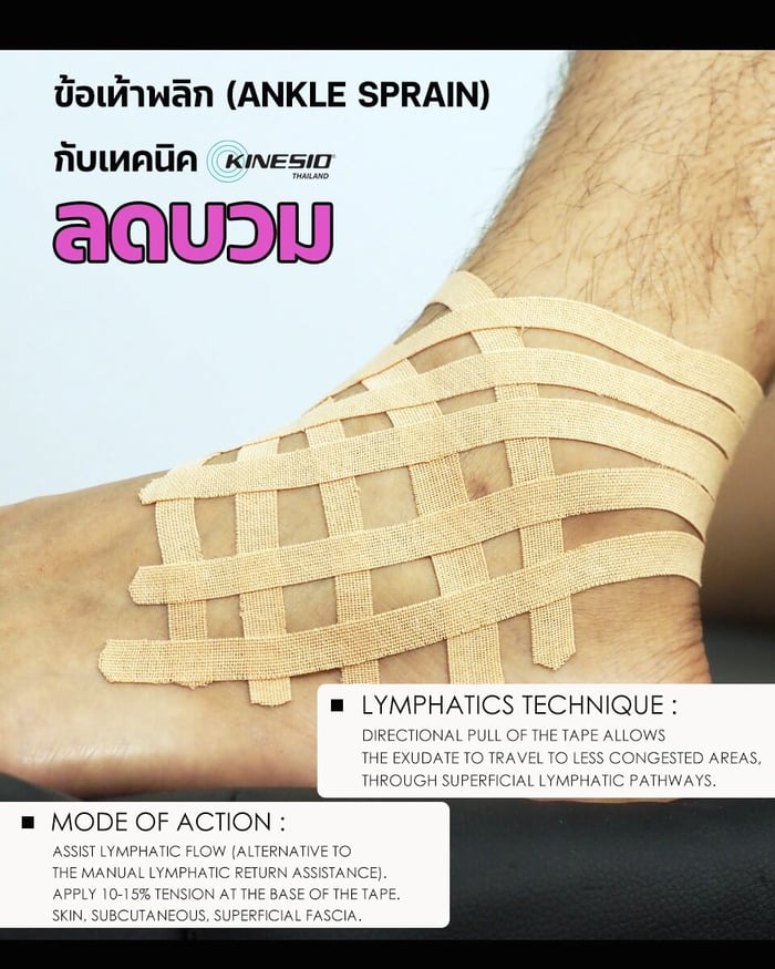 ข้อเท้าพลิก กับเทคนิคลดบวม (Ankle Sprain & Lymphatic Technique)