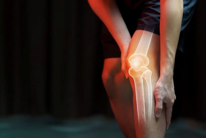 CFA ช่วยทำให้ข้อต่อเคลื่อนไหวได้ดีขึ้น ลดแรงเสียดทานและความเจ็บปวดที่เกิดจากการเคลื่อนไหว