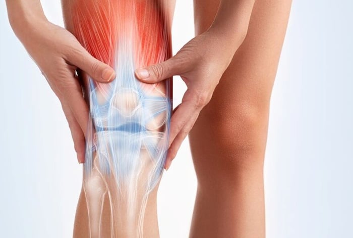 พบในคนที่ใช้เข่าหนัก เช่น นักวิ่ง ยกของหนัก หรือทำงานที่ต้องยืนตลอดทั้งวัน