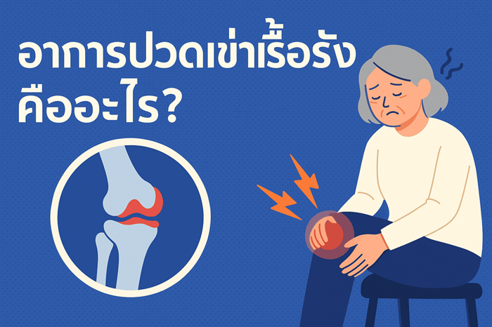 อาการปวดเข่าเรื้อรังเป็นปัญหาที่หลายคนเจอในชีวิตประจำวัน ไม่ว่าจะเป็นวัยทำงานที่ต้องยืนหรือเดินทั้งวัน ผู้สูงอายุที่เริ่มมีข้อเข่าเสื่อม หรือแม้แต่นักกีฬาที่ใช้งานข้อเข่าหนักเป็นประจำ