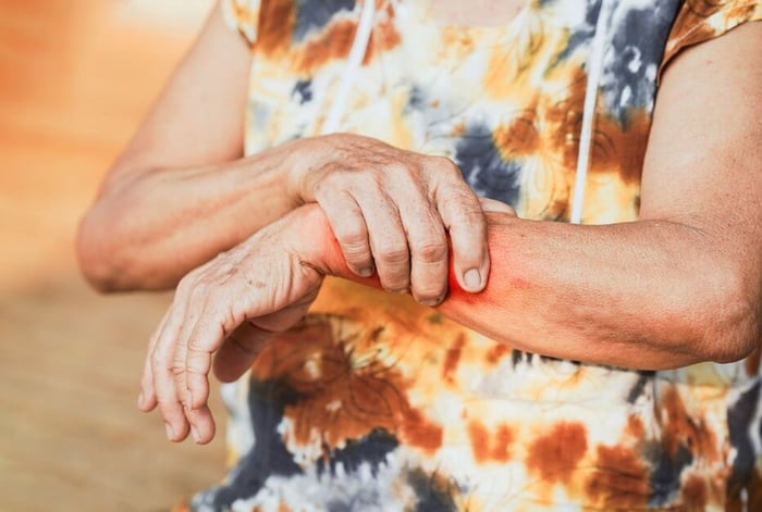 ยาทาแบบร้อนมีสารออกฤทธิ์อย่าง Menthol หรือ Levomenthol ที่ช่วยขยายหลอดเลือด กระตุ้นการไหลเวียนโลหิต ทำให้บริเวณที่ทารู้สึกอุ่น ช่วยคลายกล้ามเนื้อและลดอาการปวดที่สะสมมานาน