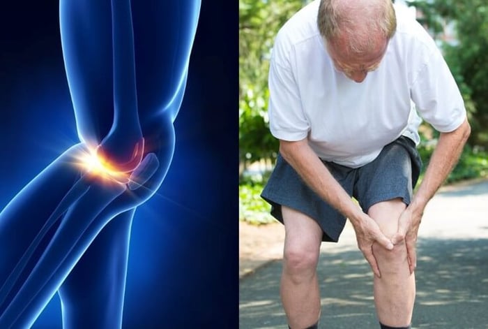 🌿 ทางเลือกใหม่ของการแก้ปวด: Cetylated Fatty Acid (CFA)