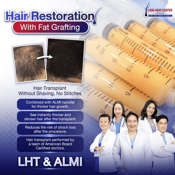 Real Case! Australian Doctor Flies to Thailand for Hair Restoration with Dr. Top, Long Hair x ALMI Nano Fat