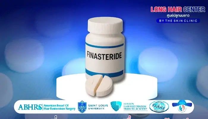 : A Survival Guide to Coping with the Side Effects of Finasteride