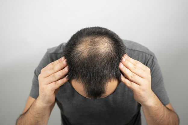How to Maintain Healthy Hair and Minimize Hair Loss?