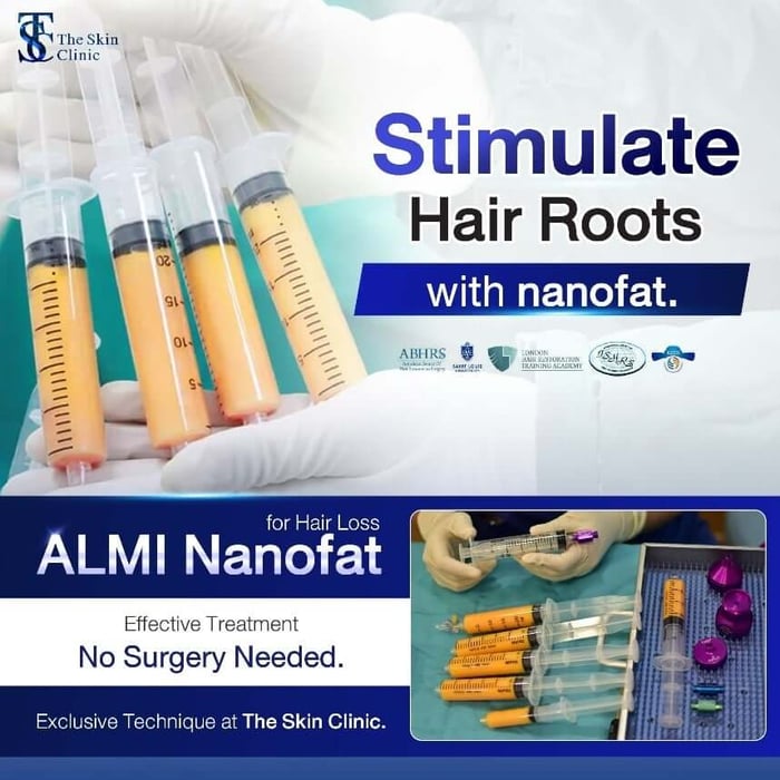 ALMI Nano Fat (Autologous Lipocyte Micronized Injection)