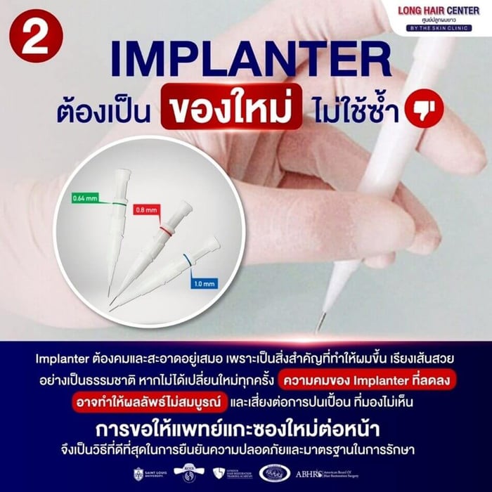 Ask to see the implanter pen used for graft placementAsk to see the implanter pen used for graft placement