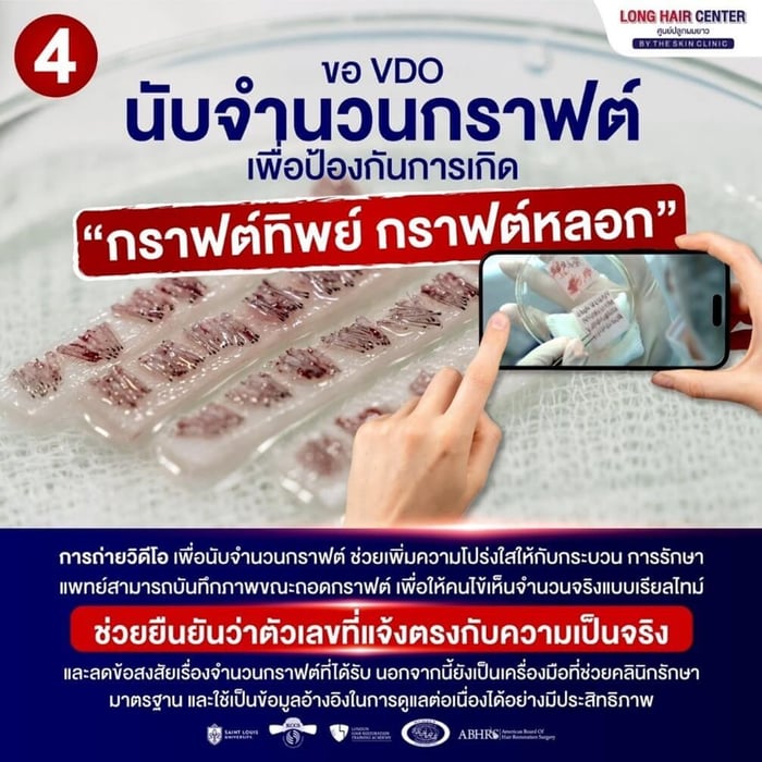 Ask to see how the number of grafts is counted