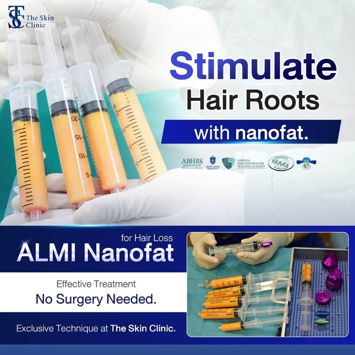 What is ALMI Nanofat?