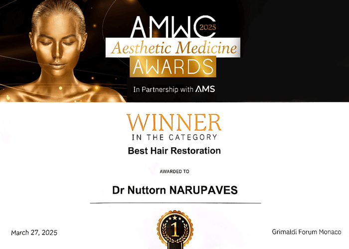 Hair Transplant, ปลูกผม FUE, Hair loss