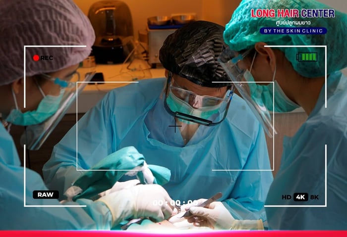 Hair Transplant Procedures