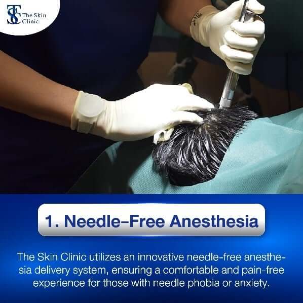 Needle-free anesthesia