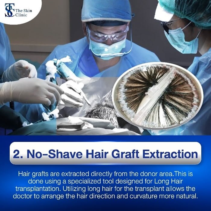 Extraction of long hair grafts