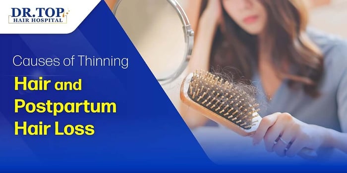 Thinning Hair After Childbirth: What Can Moms Do? Essential Hair Transplant Methods Every Mother Should Know!