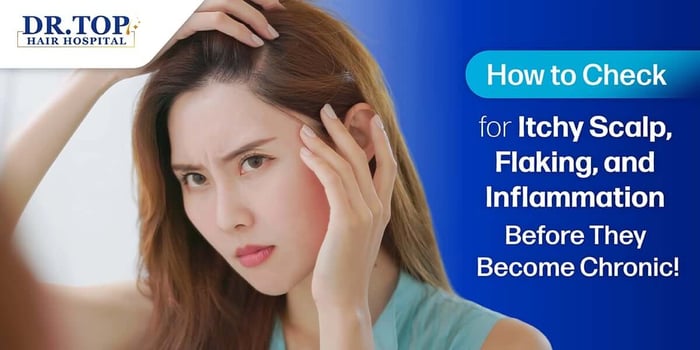 What Causes Itchy Hair, Flaky Scalp, and Inflamed Scalp