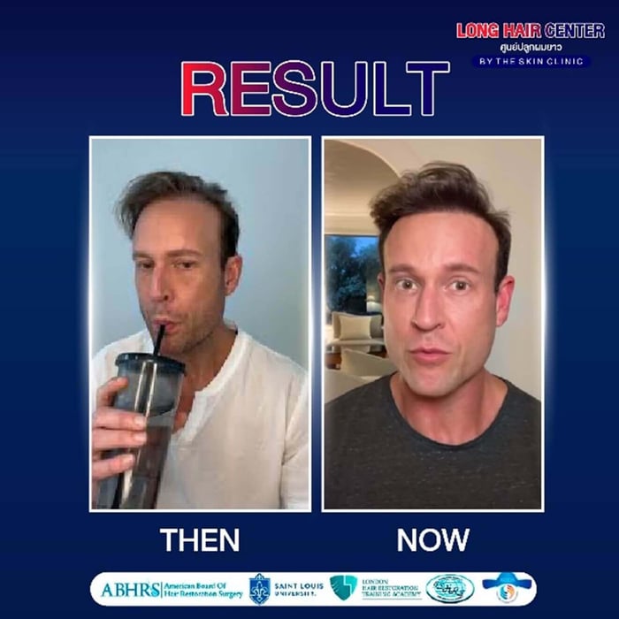 at The Skin Clinic. We'll assess your hair condition and develop a tailored treatment plan that suits your goals