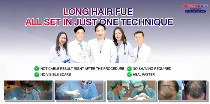 A hair transplantation technique for your consideration.