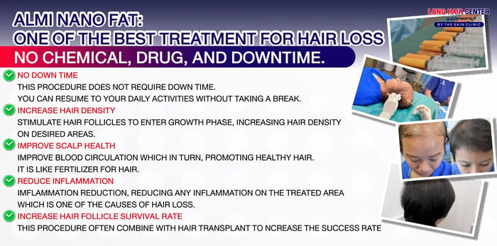 Hair Transplantation, For those who doesn’t want to undergo a hair transplantation