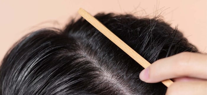 Expecting Hair to Last a Lifetime